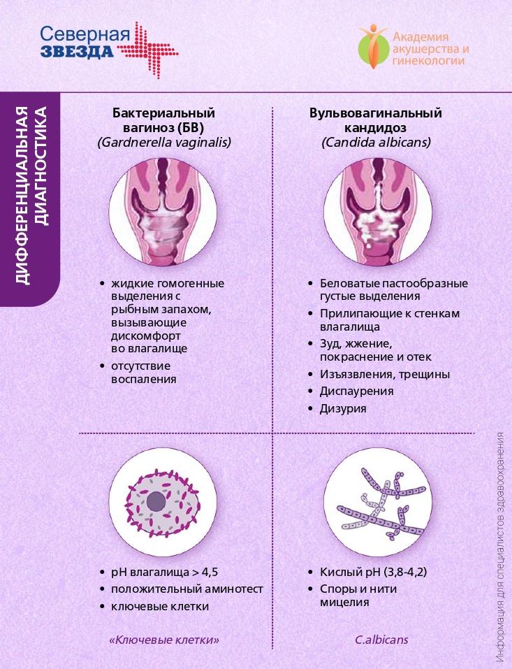 Бактериальный вагиноз, гарднереллез, дисбиоз, дисбактериоз влагалища: причины, симптомы, лечение